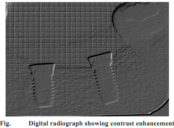 2221_What is Digital periapical radiography.png